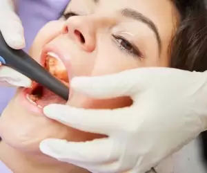 Root Canal Treatment in Turkey