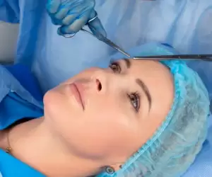 Eyelid Esthetic Surgery in Turkey