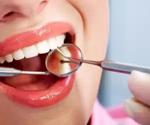 Dental Vaneer in Turkey